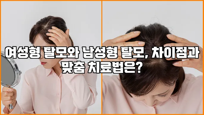 여성형 탈모와 남성형 탈모, 차이점과 맞춤 치료법은?